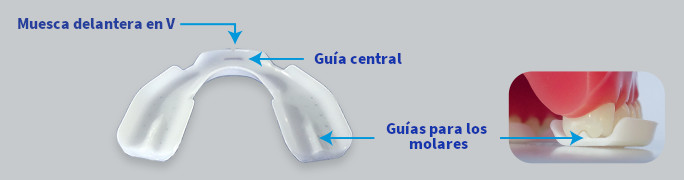 Férula Dental para Dormir Anti-Bruxismo, protector bucal ortodoncia por  Tmvgtek Deportes Acuáticos